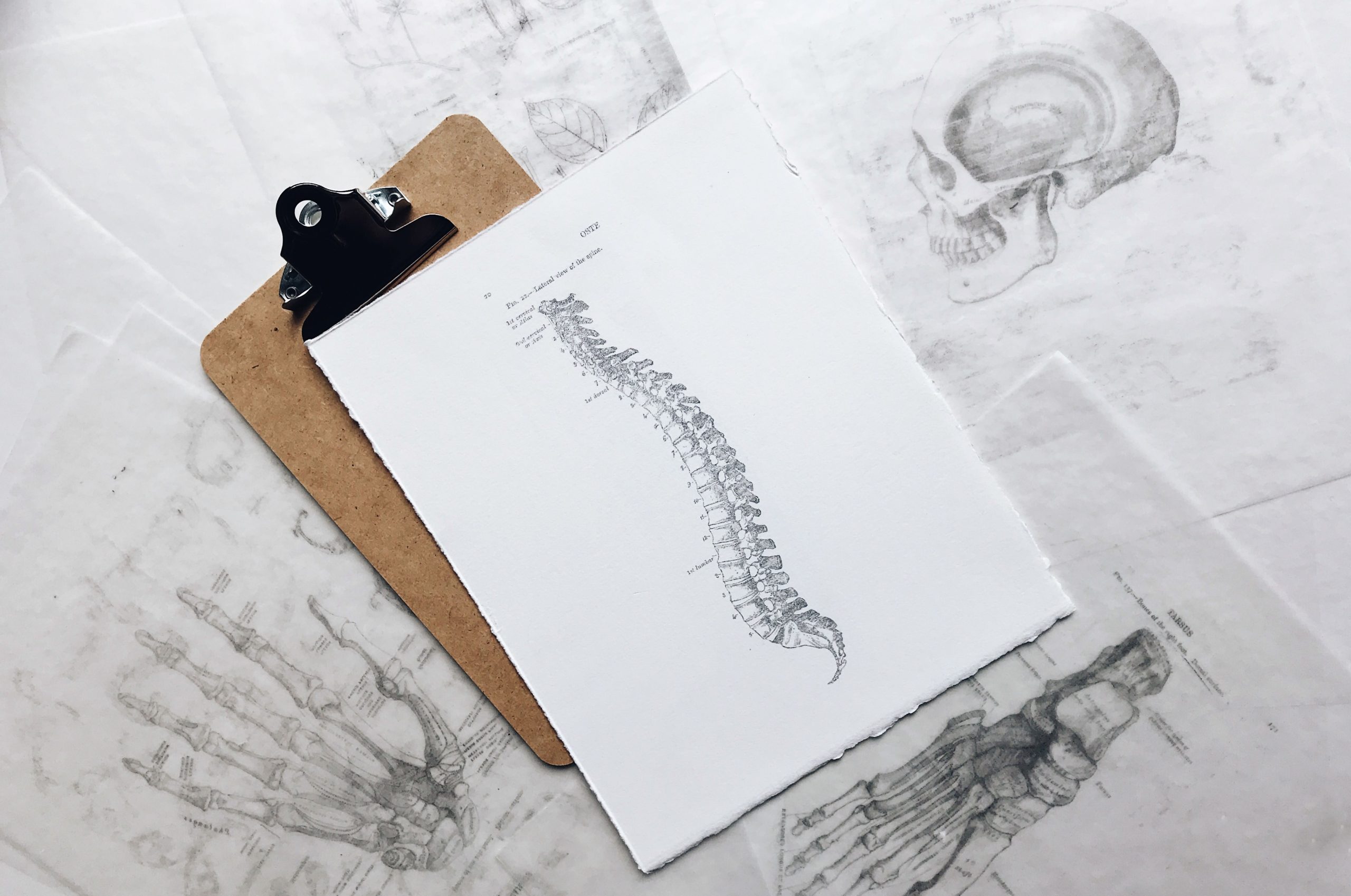 Clipboard with paper depicting a diagram of a spine